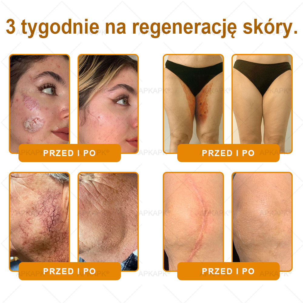 Polecane przez USK w Białymstoku · Wyprodukowano w Polsce✨✨ 𝖠𝖯𝖪𝖠𝖯𝖪® krem regenerujący skórę z jadem pszczelim