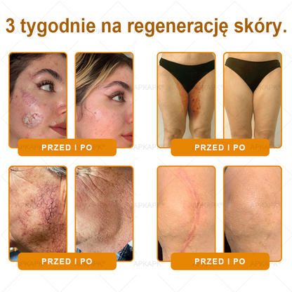 Polecane przez USK w Białymstoku · Wyprodukowano w Polsce✨✨ 𝖠𝖯𝖪𝖠𝖯𝖪® krem regenerujący skórę z jadem pszczelim