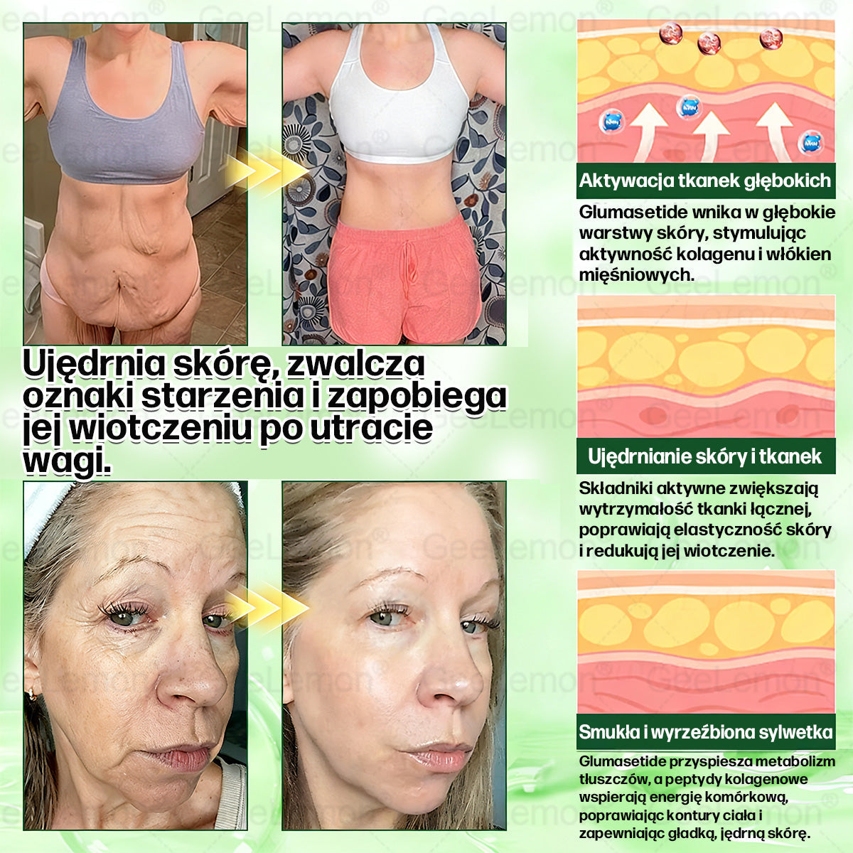 Oficjalny Sklep | 👩‍⚕️🎁 𝐆𝐞𝑒𝐿𝑒𝐦𝐨𝐧® 𝐆𝐥𝐮𝐦ase𝐭𝐢𝐝𝐞 𝟖 𝐰 𝟏 Smukły i Zdrowy Nano Plaster z Mikronakłuciami 🇵🇱(Tylko raz dziennie, widoczne zmiany już w 7 dni)✅ Na otyłość, 🅛🅞🅞🅢🅔 🅢🅚🅘🅝 wiotką skórę, cukrzycę, bezdech senny, problemy ze stawami i wiele więcej