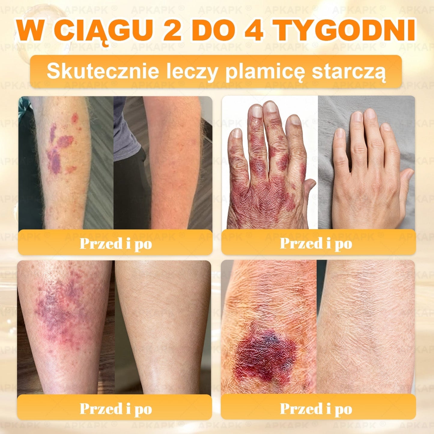 Polecane przez USK w Białymstoku · Wyprodukowano w Polsce✨✨ 𝖠𝖯𝖪𝖠𝖯𝖪® krem regenerujący skórę z jadem pszczelim