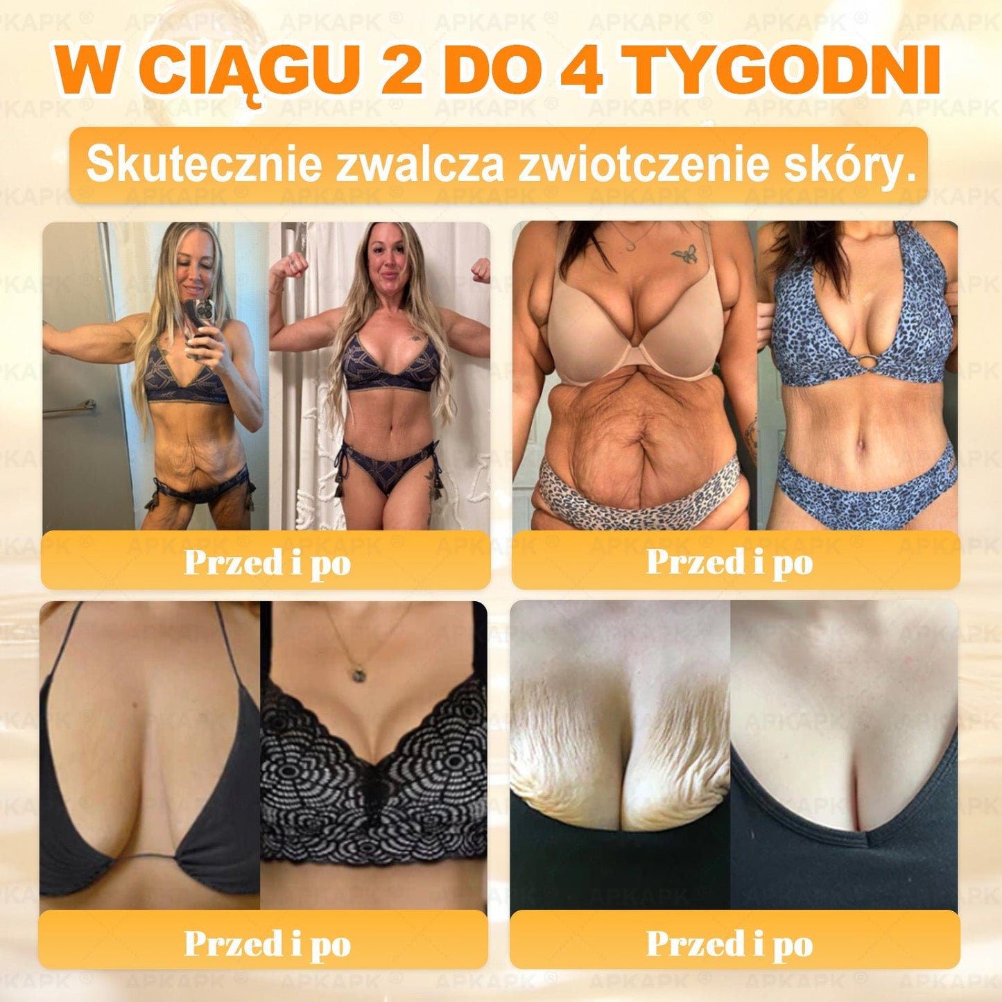 Polecane przez USK w Białymstoku · Wyprodukowano w Polsce✨✨ 𝖠𝖯𝖪𝖠𝖯𝖪® krem regenerujący skórę z jadem pszczelim