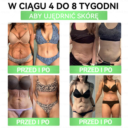 Oficjalny Sklep | 👩‍⚕️🎁 𝐆𝐞𝑒𝐿𝑒𝐦𝐨𝐧® 𝐆𝐥𝐮𝐦ase𝐭𝐢𝐝𝐞 𝟖 𝐰 𝟏 Smukły i Zdrowy Nano Plaster z Mikronakłuciami 🇵🇱(Tylko raz dziennie, widoczne zmiany już w 7 dni)✅ Na otyłość, 🅛🅞🅞🅢🅔 🅢🅚🅘🅝 wiotką skórę, cukrzycę, bezdech senny, problemy ze stawami i wiele więcej