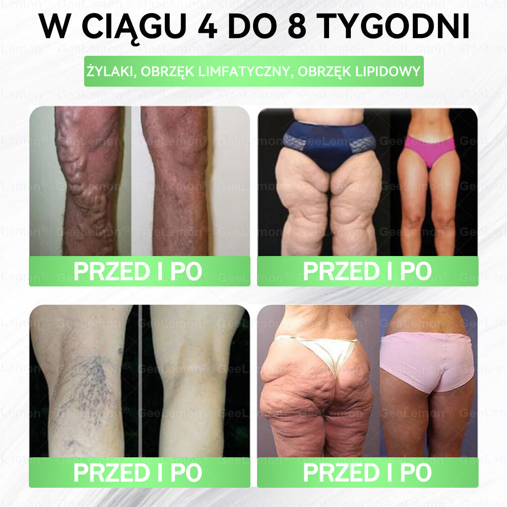 Oficjalny Sklep | 👩‍⚕️🎁 𝐆𝐞𝑒𝐿𝑒𝐦𝐨𝐧® 𝐆𝐥𝐮𝐦ase𝐭𝐢𝐝𝐞 𝟖 𝐰 𝟏 Smukły i Zdrowy Nano Plaster z Mikronakłuciami 🇵🇱(Tylko raz dziennie, widoczne zmiany już w 7 dni)✅ Na otyłość, 🅛🅞🅞🅢🅔 🅢🅚🅘🅝 wiotką skórę, cukrzycę, bezdech senny, problemy ze stawami i wiele więcej