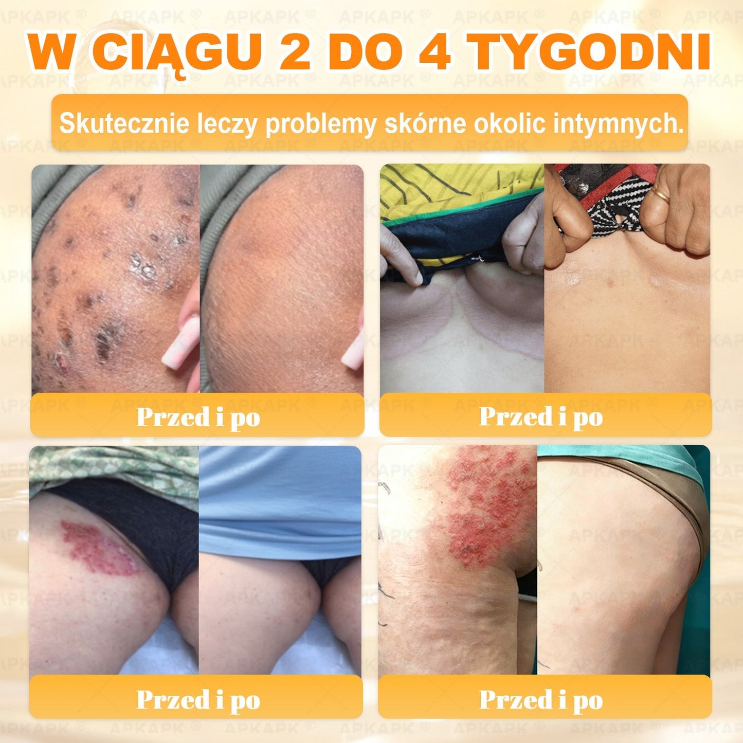 Polecane przez USK w Białymstoku · Wyprodukowano w Polsce✨✨ 𝖠𝖯𝖪𝖠𝖯𝖪® krem regenerujący skórę z jadem pszczelim