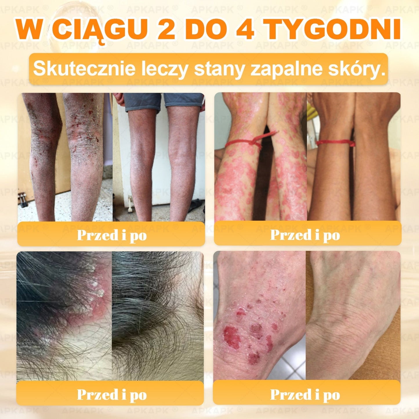 Polecane przez USK w Białymstoku · Wyprodukowano w Polsce✨✨ 𝖠𝖯𝖪𝖠𝖯𝖪® krem regenerujący skórę z jadem pszczelim